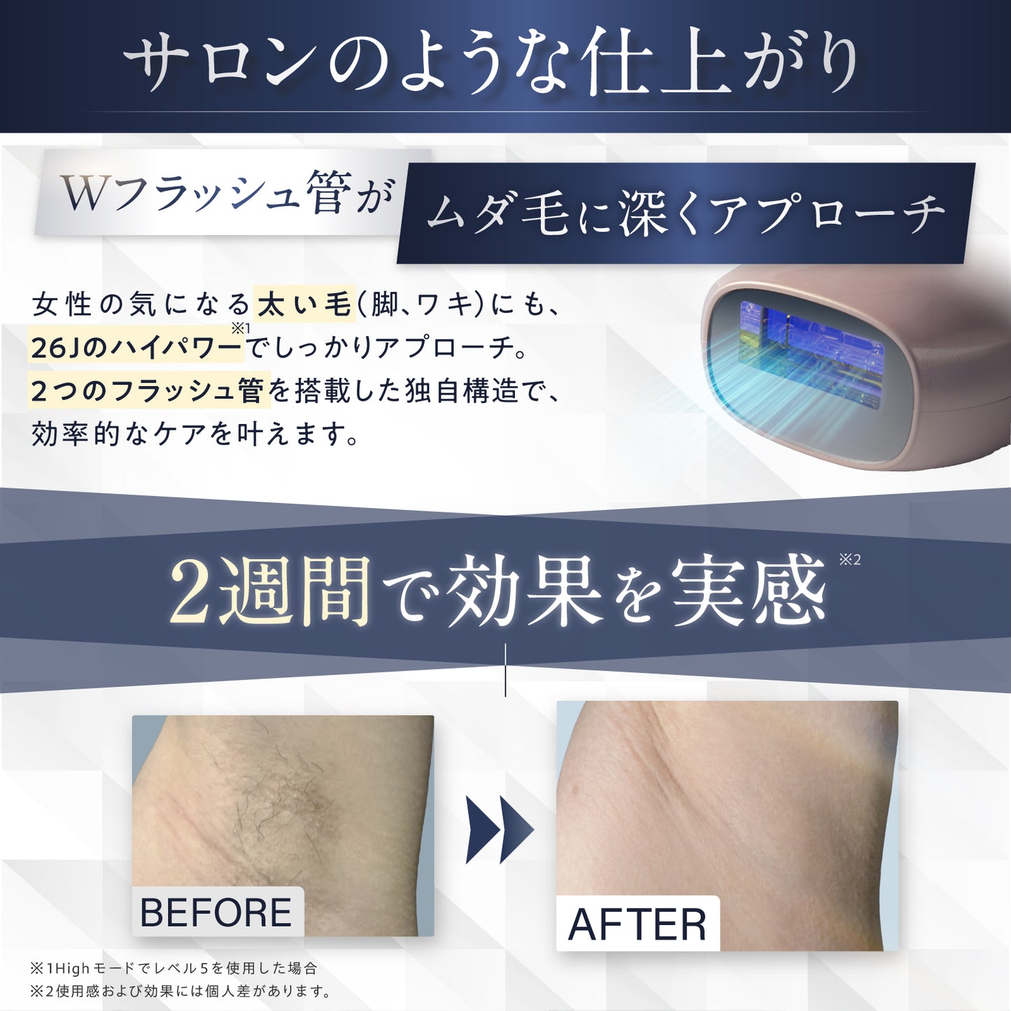 BEPLEA 家庭用光美容脱毛器 BEP-NBL729